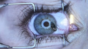 auge